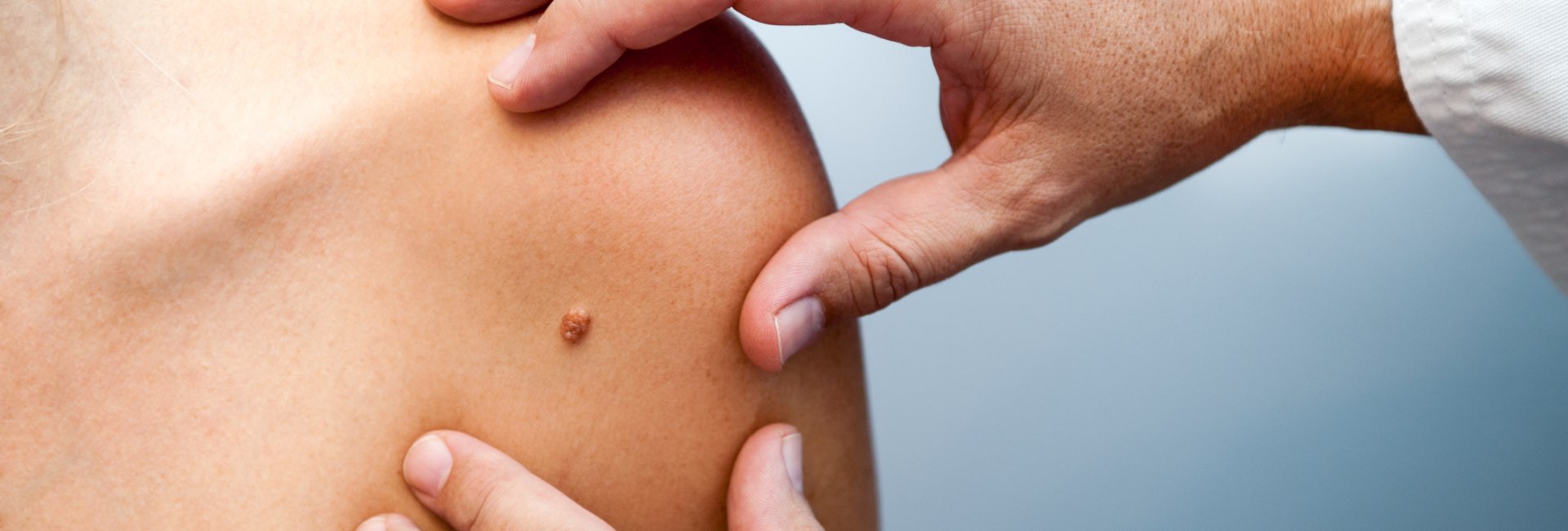 Dermatologie
